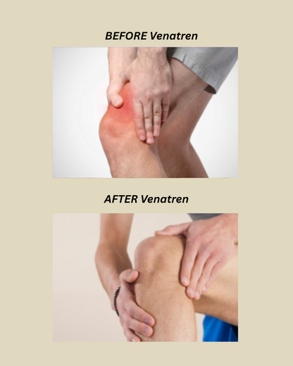 Venatren Bee Venom & Turmeric Arthritis Therapy Cream